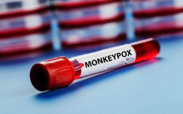WSGW OnLine Poll:     Monkeypox  (results)